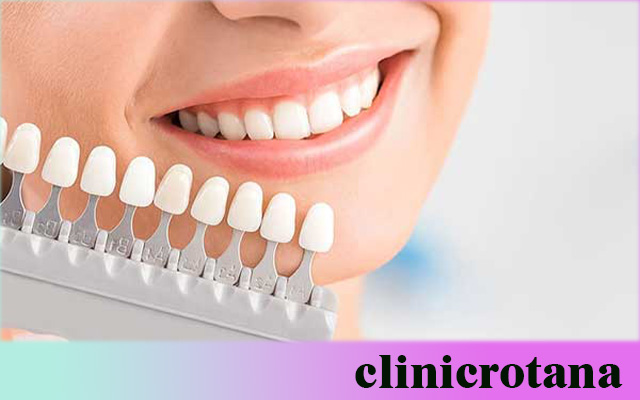 علاج الفم والأسنان في تركيا