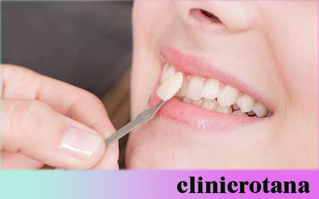 علاج تسوس الأسنان في تركيا