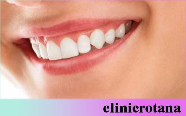 خدمات طب الأسنان المتقدمة في تركيا 2025