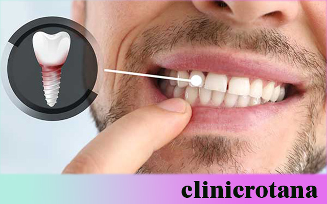 مراكز صحة الفم في تركيا