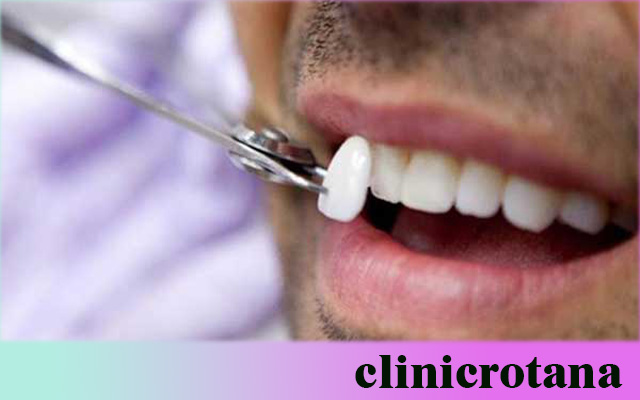 رعاية الأسنان في تركيا