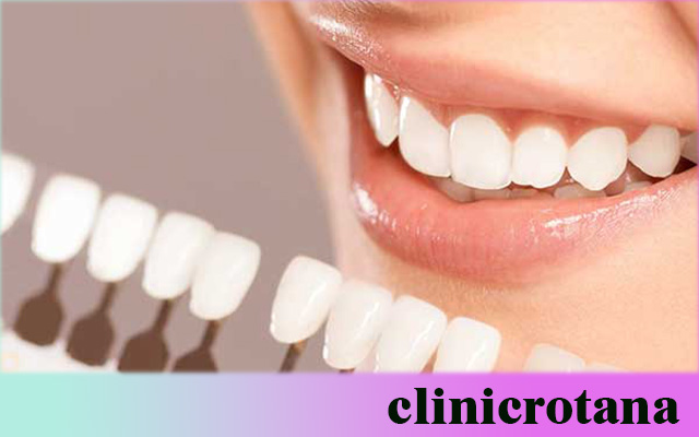 تخصصات طب الأسنان في تركيا