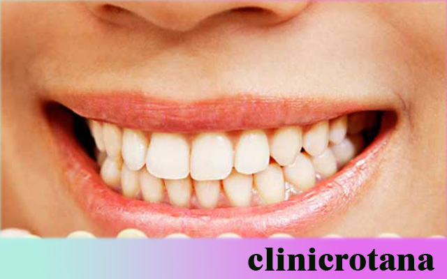 علاج أمراض اللثة في تركيا