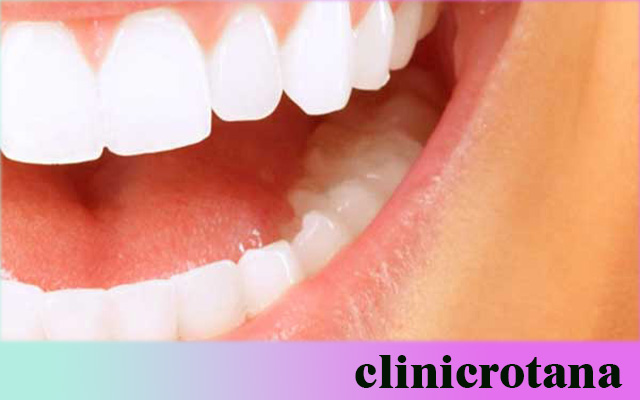 أفضل منظومة علاج أسنان في تركيا